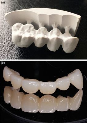 Zirconia: Un Materiale Refractario e Innovativo per le Applicazioni Industriali ad Alta Temperatura!